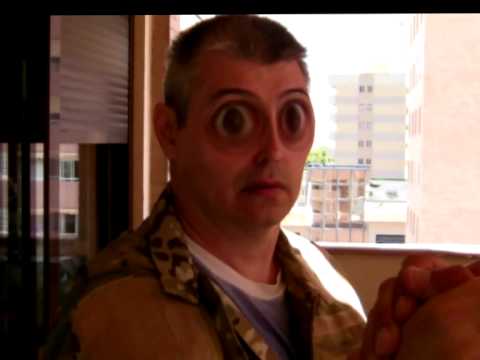 SAMUREÑA 2: Previo Rotura brazo