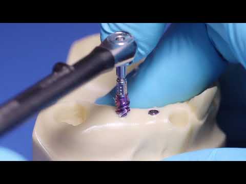 Straumann® BLX Implant System - Healed Sites