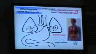 Dr Azza  Nematodes 5   Anclystoma Duodenale   YouTube