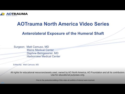 Humerus   Anterolateral Humeral Shaft Exposure