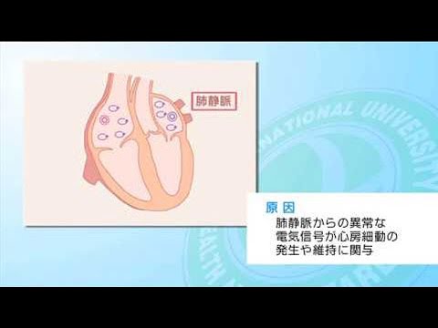 国際医療福祉大学病院　カテーテルアブレーション