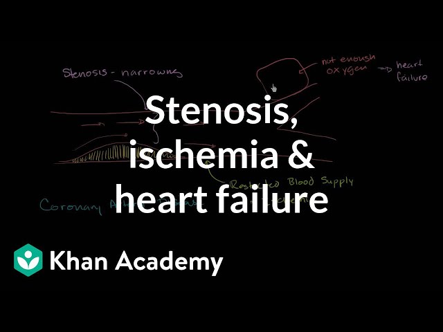 הגיית וידאו של ischemia בשנת אנגלית