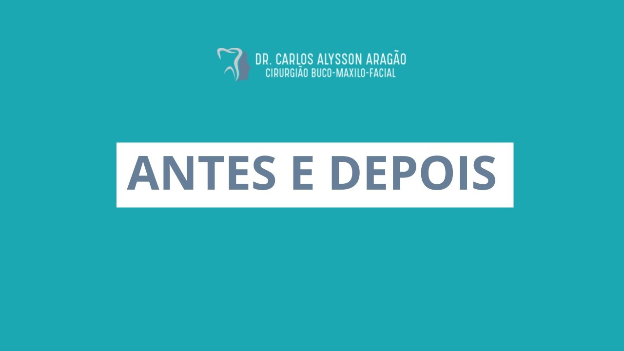 Carlos Alysson Aragão-44