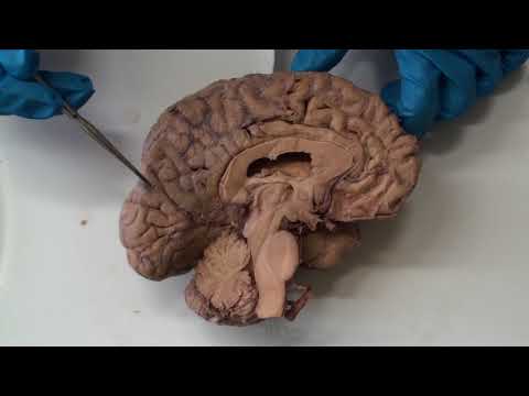 Gyri and Sulci of the Half Brain