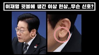 이재명 귓볼에 생긴 이상 현상..무슨 신호? 네티즌들 술렁...