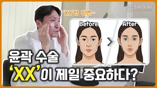 윤곽수술을 할 때 뭐가 가장 중요할까요? 가장 많이 하는 질문 모음!!!