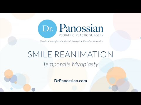 Smile Reanimation using Temporalis Myoplasty