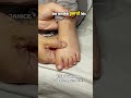 Sakit Perut Auto Minggat Pijat Pada Titik Titik Di Video Pijatanak Tipsparenting