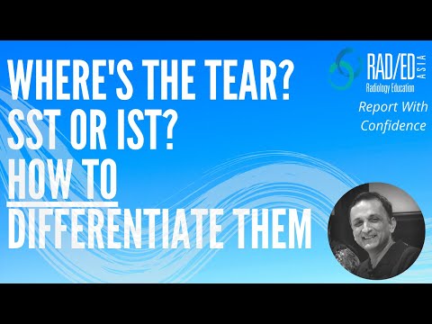 MRI Rotator Cuff Tear. Is it Supraspinatus or Infraspinatus? MRI Online Review Learn MSK MRI