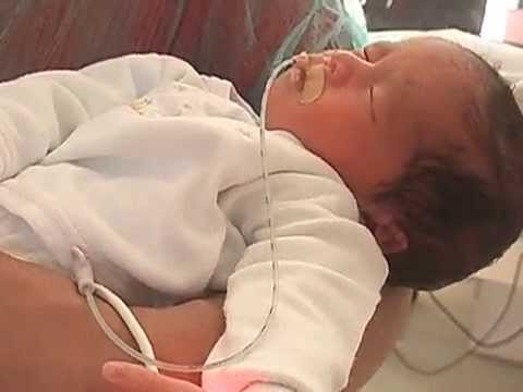 Ana Julia e Ana sofia Nos Primeiros Dias De Vida..