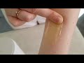 Shugaring Deep Bikini 18.of The Interdigital Fold Or What I Do Shugaring.waxing Woman. Depilation.