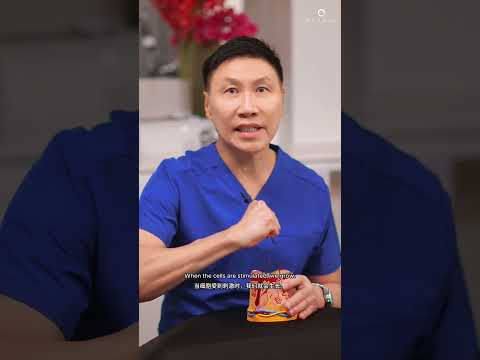 Why Pico Laser didn't clear my Melasma? | Ensoul Medical Clinic