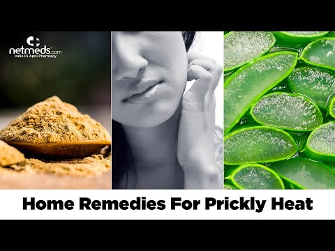Prickly Heat: 5 Natural R..