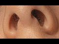Actress Parineeti Chopra Vertically Edit Face Closeup