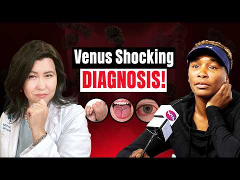 Venus Williams Battle with Sjogren's Disease and The Newest Treatments