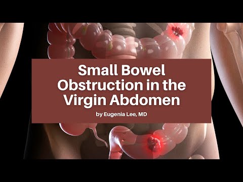 Small Bowel Obstruction in the Virgin Abdomen | The USC Trauma & Surgery Course