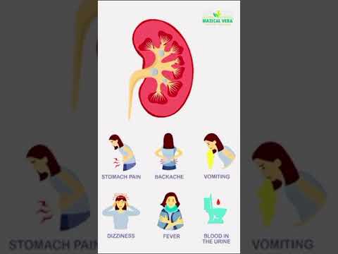 Kidney stones ayurvedic medicine, syrup + capsule