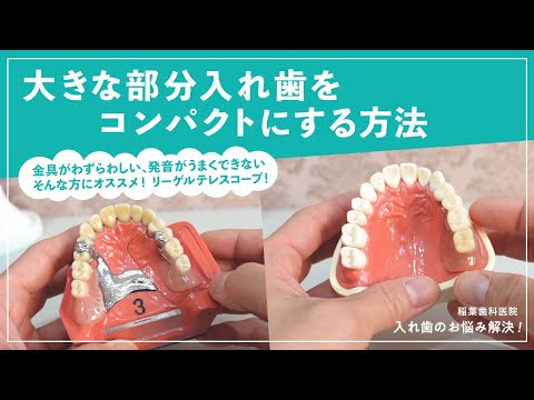 大きな部分入れ歯をコンパクトにする方法
