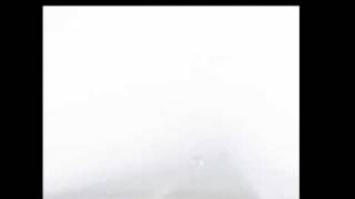 RAA - Under the knife