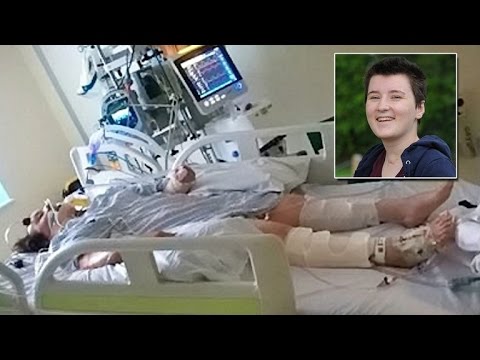 Woman in Coma Wiggled Toe Just As Doctor's Were About to Turn Off Life Support