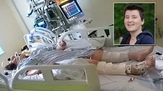 Woman in Coma Wiggled Toe Just As Doctor