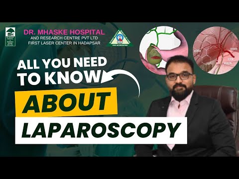 Discover the Truth About Laparoscopy, Debunking Myths and Revealing Facts! Watch the whole video to clear all those doubts! 
