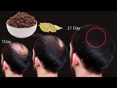 Japanese doctors cured my baldness with this recipe! Hair grows like crazy!