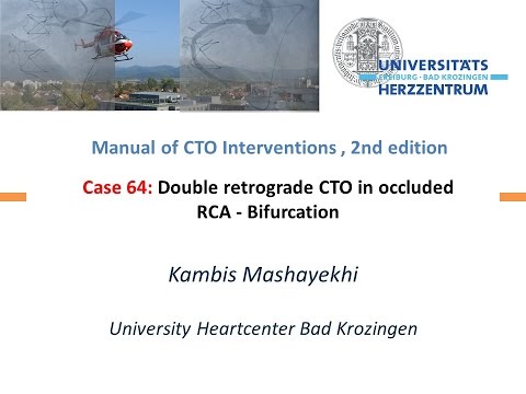Case 64: Manual of CTO Interventions - Double retrograde for bifurcation at distal cap