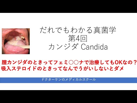  4 最も一般的な真菌性疾患と治療法