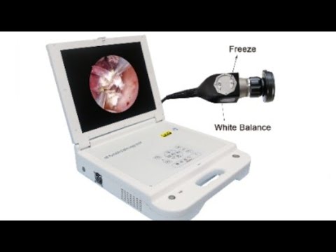 Portable Endoscopy Unit Camera