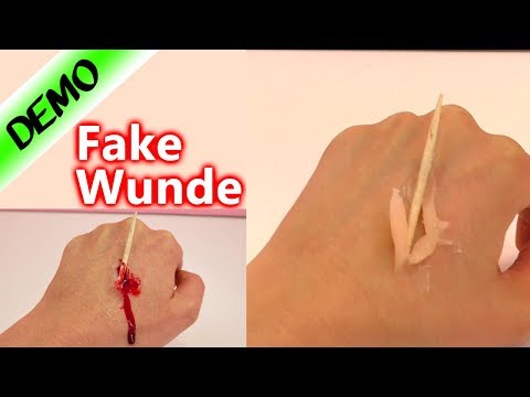 Neuralgie des Kiefergelenks Gelenkkapsel Behandlung