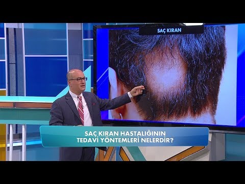 , title : 'Saç kıran nasıl tedavi edilir? Balçiçek ile Dr. Cankurtaran 50. Bölüm'