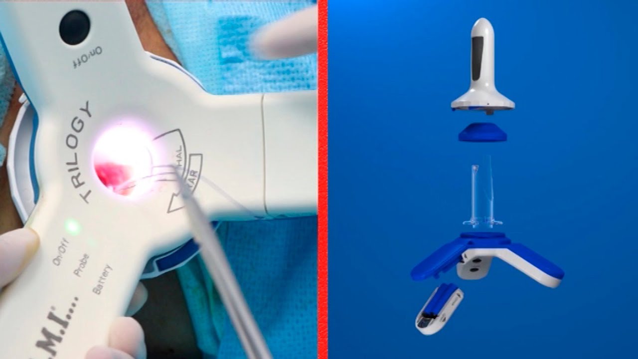 Ликвидация геморроя