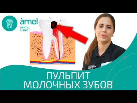 Пульпит - симптомы, лечение, как избежать возникновения?
