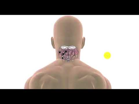 Trigger Point Therapy | Tension Headache | Suboccipital Muscles