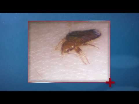 Bed Bugs & Disease - Health Checks