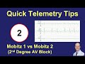 Telemetry Tips 2nd Degree AV Block Mobitz 1 Mobitz 2 And 2 1