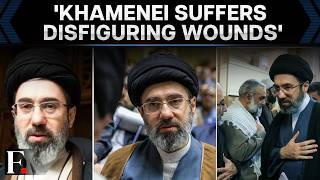 Iran's Supreme Leader Mojtaba Khamenei Suffers Disfiguring Facial and Leg Wounds: Reports | N18G