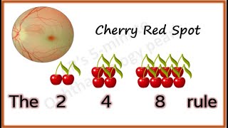 Cherry Red Spot