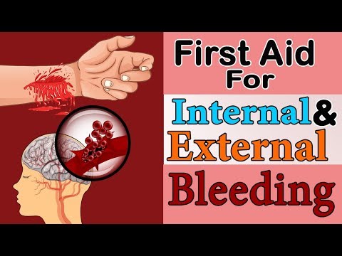 First Aid for External & Internal Bleeding | Great Wall Corporate Services