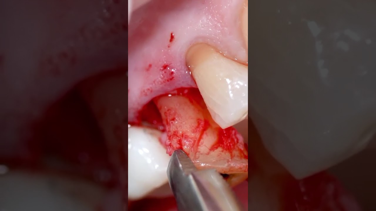 Nini Johana Naranjo Alzate-1