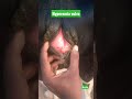 Hyperemia Vulva Mucus Membrane Animal Animals Bloods Cow Cows Cattle Cattles Vet Veterinary Veteran