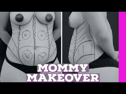 MOMMY MAKEOVER