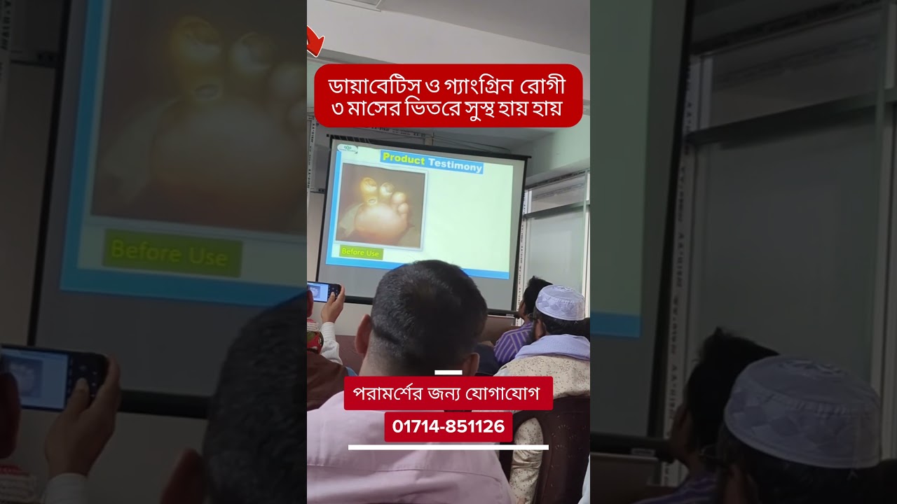 ডায়াবেটিস ও গ্যাংগ্রিন রোগে ৩ মাসের ভিতরে সুস্থ