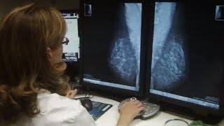 Área de Patología Mamaria de la Clínica - Fernando Martínez Regueira