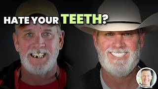 All-On-X Dental Implants in Springfield, MO | Dr. Olson’s Free Full Mouth Implant Webinar