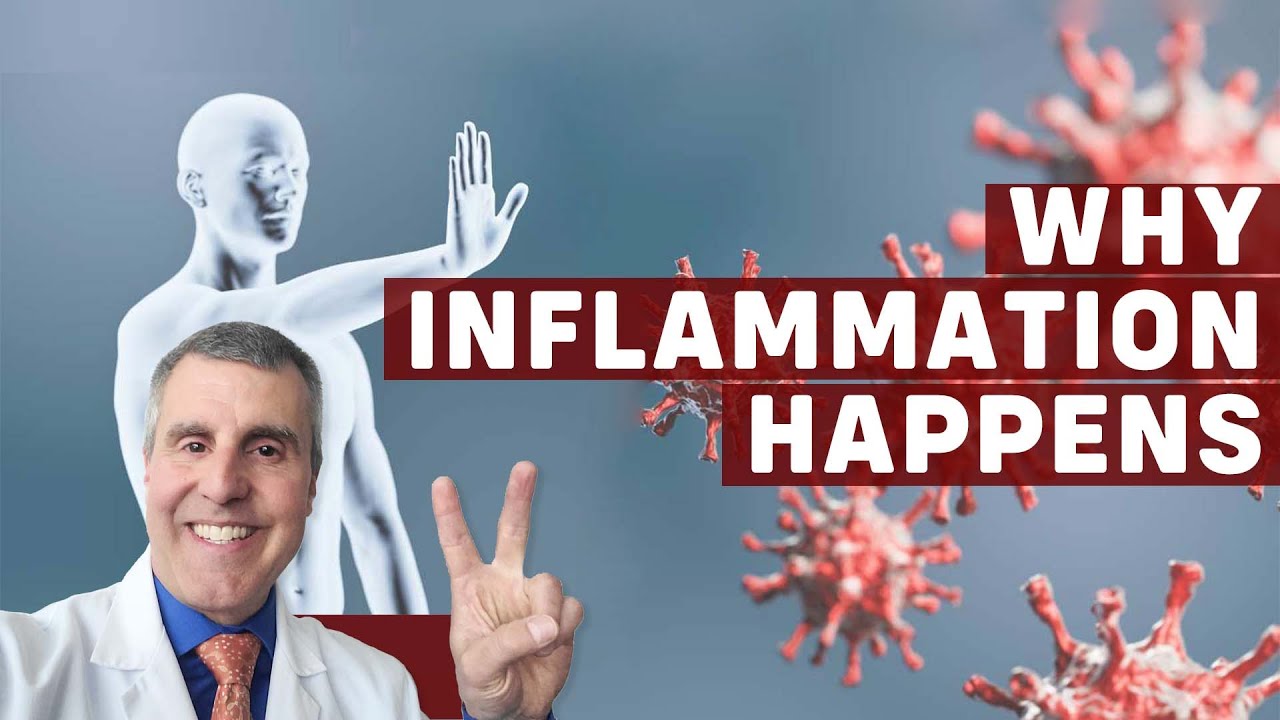 Essentials of Inflammation Ep. 2: The Things That Trigger the Immune System to Generate Inflammation