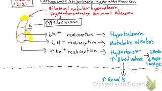 Primary hyperaldosteronism