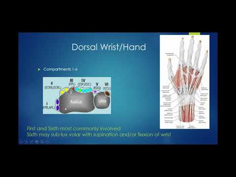 Diagnostic Ultrasound of the Wrist and Hand