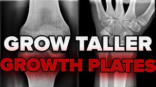 How to Tell If Your Growth Plates Are Open Without An X-Ray
